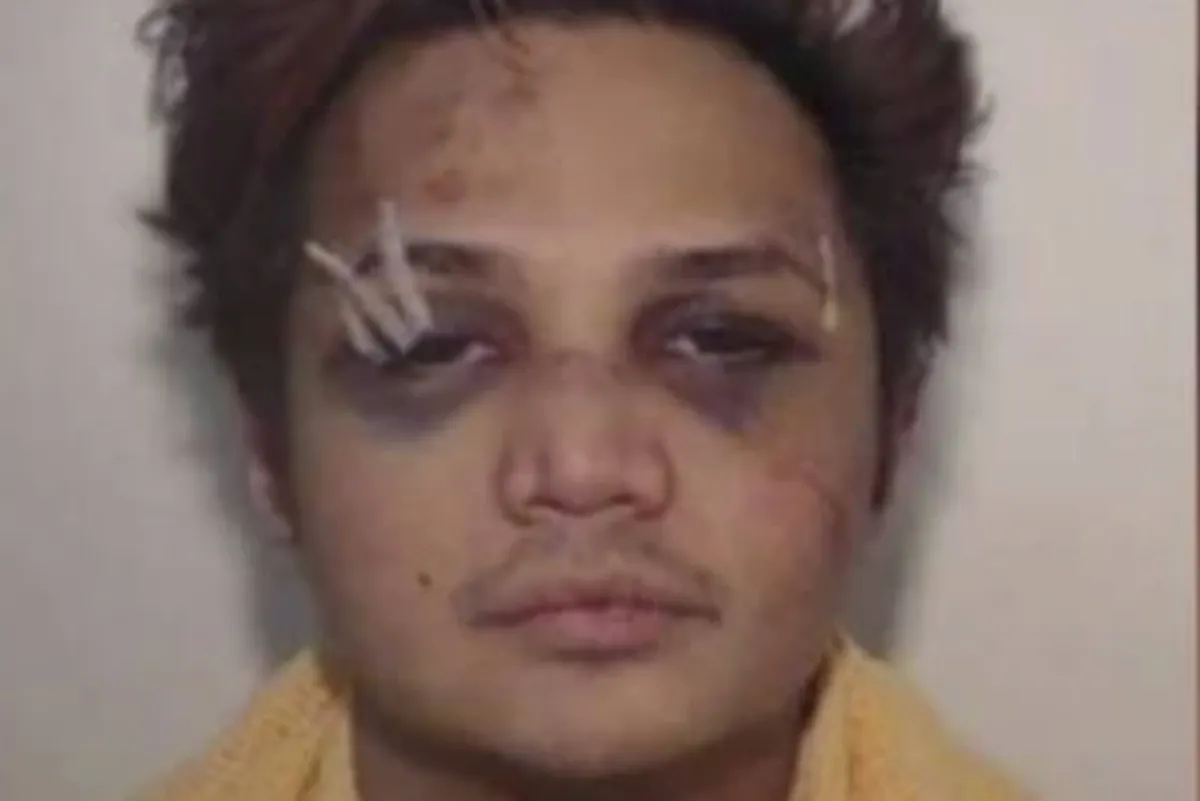 Wajah Reynhard SInaga babak belur setelah dihajar Jack McRae. (Sumber: Greater Manchester Police)