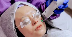 Di tengah geliat industri kecantikan yang terus berkembang, Kota Bandung menjelma menjadi salah satu pusat tren perawatan kulit di Indonesia. (Sumber: dok. Adeeva Aesthetic Clinic)