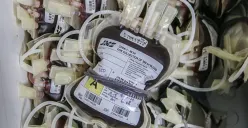 Sekitar Separuh Penduduk Kota Bandung Tidak Tahu Golongan Darahnya