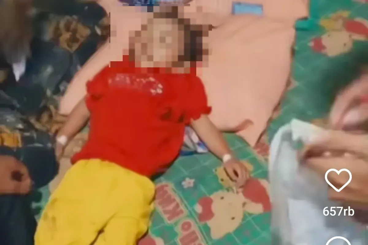 Raya, balita di Sukabumi yang meninggal akibat cacingat akut. (Sumber: Screenshoot Video Rumah Teduh)
