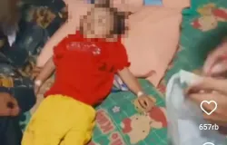 Raya, balita di Sukabumi yang meninggal akibat cacingat akut. (Sumber: Screenshoot Video Rumah Teduh)