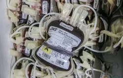 Kantong-kantong darah dari pendonor. (Sumber: ayobandung.id | Foto: Andres Fatubun)